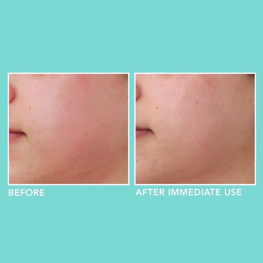 Soothe & Hydrate Serum